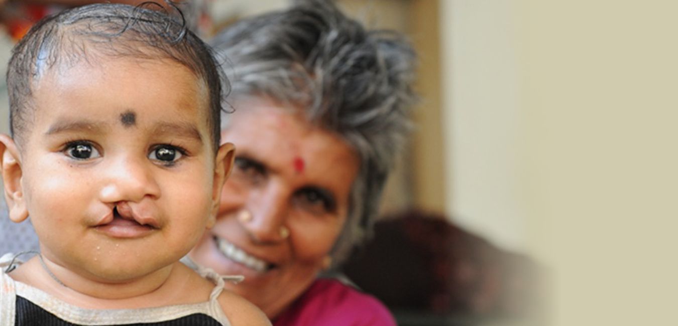 Craniofacial Surgery